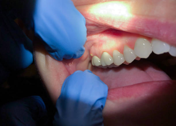 Best Cracked Tooth Emergency Dentist  in Mound, MN